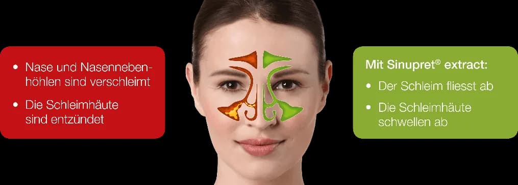 Die besten Medikamente bei Nasennebenhöhlenentzündung für schnelle Linderung