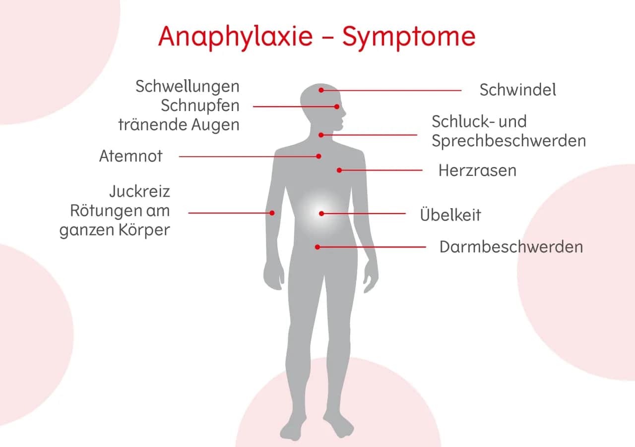 Allergie Symptome: So erkennen Sie gefährliche Reaktionen rechtzeitig