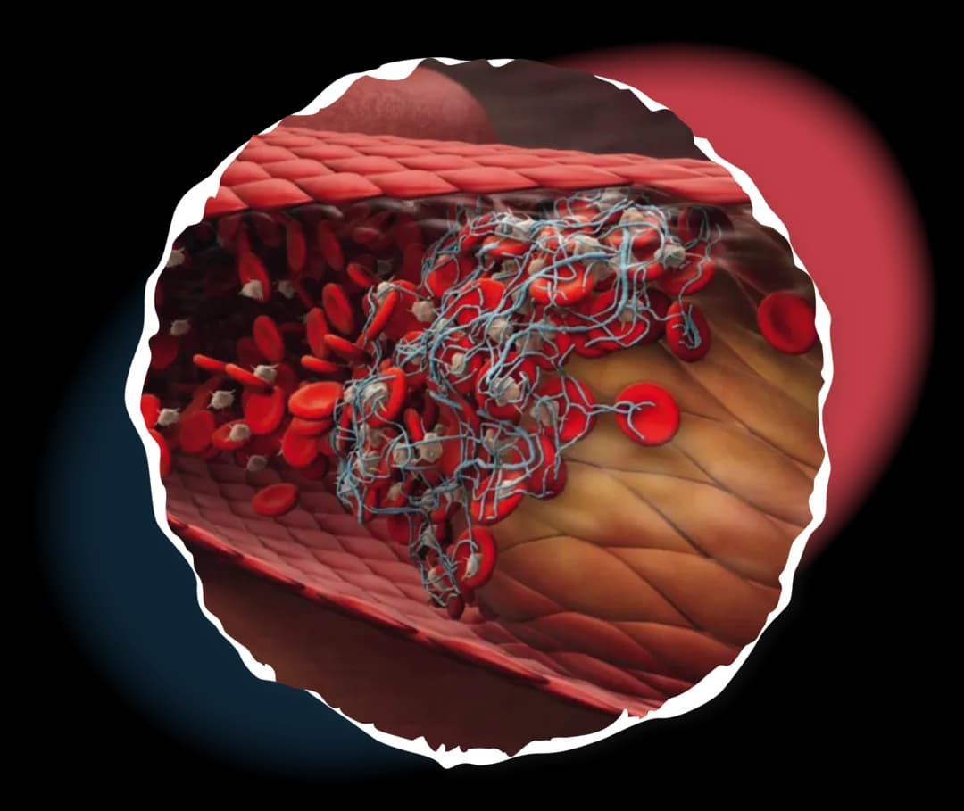 Polycythaemia vera symptome: Erkennen Sie die versteckten Warnsignale