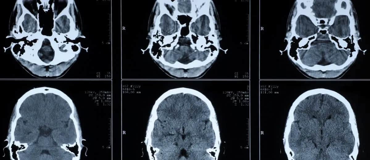 Die Bedeutung der medizinischen Diagnostik für präzise Krankheitsdiagnosen