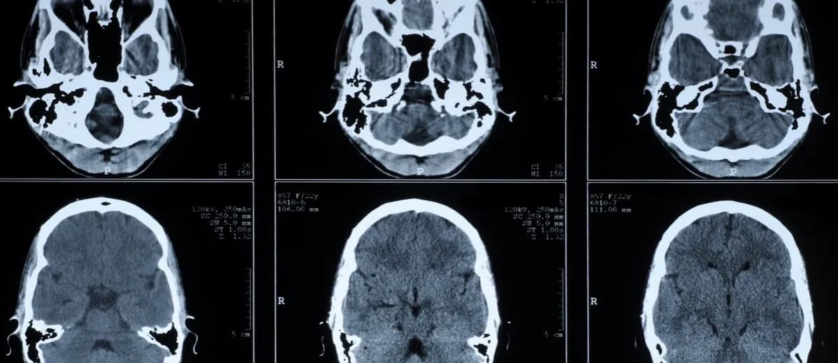 Die Bedeutung der medizinischen Diagnostik für präzise Krankheitsdiagnosen