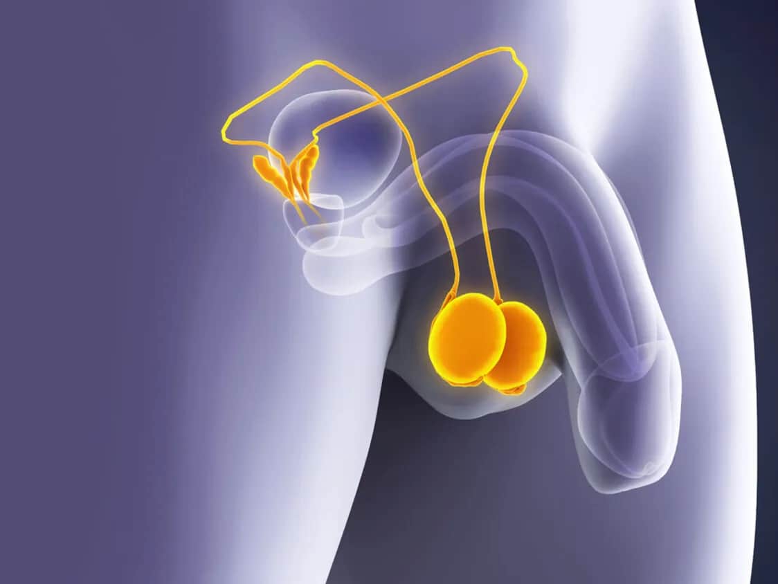 Hodenkrebs Vorsorge: So schützen Sie sich effektiv vor Krebsrisiken